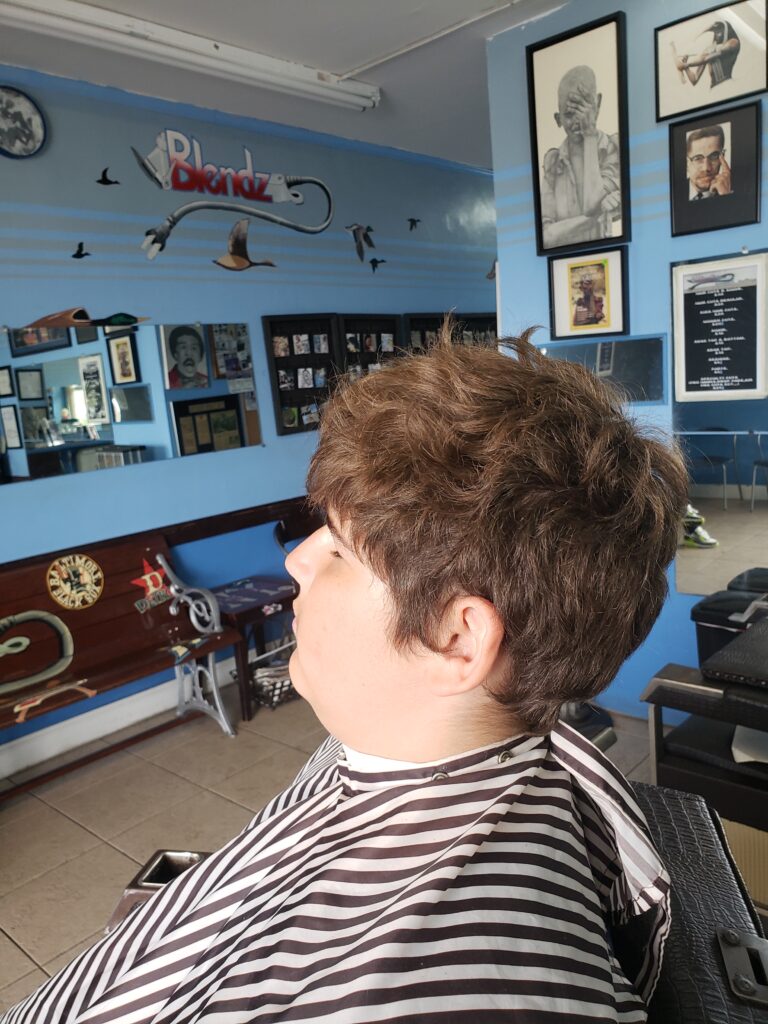 BEFORE (Bald Fade)