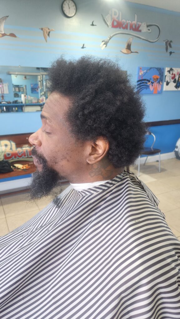 BEFORE (Bald Fade)